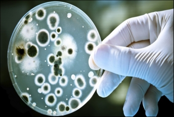  10 ملايين شخص سنويًّا ضحايا 12 عائلة من البكتيريا.. تعرف إليها