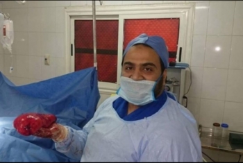  أطباء جامعة الزقازيق ينجحون في استئصال ورم وزنه 1.5 كيلو من قدم مريضة